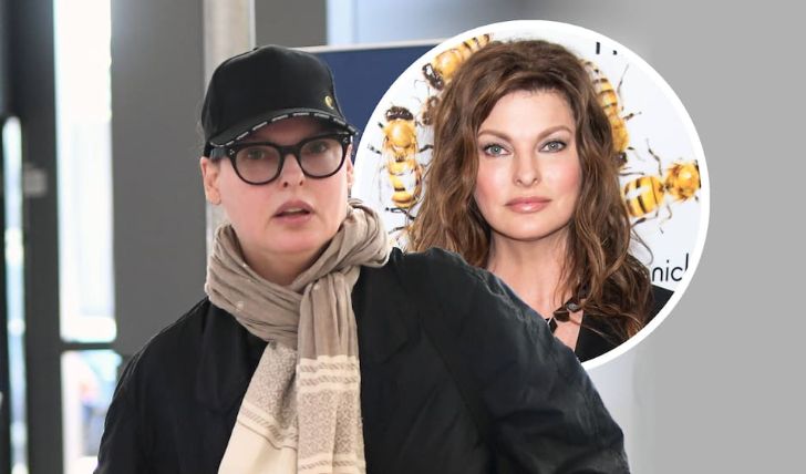 Learn all the Details About Linda Evangelista's Cosmetic Surgery Here
